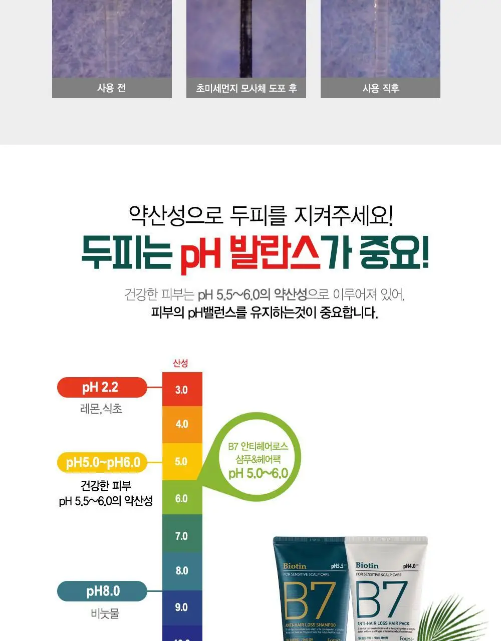 [광고비_안태운_품질] 포레스트스토리 B7 안티 헤어 로스 샴푸 200ml 상세페이지 7